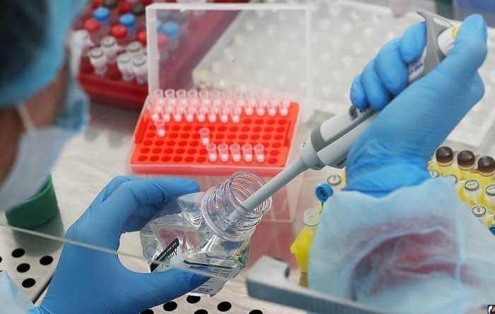 Страны ЕАЭС получили российские тесты на коронавирус. 